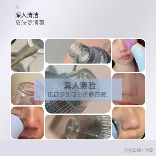 吸黑頭儀哪個品牌好用?2026年推薦的10款型號:性價比高效果好!
